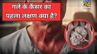 Gale Ke Cancer Ke Lakshan