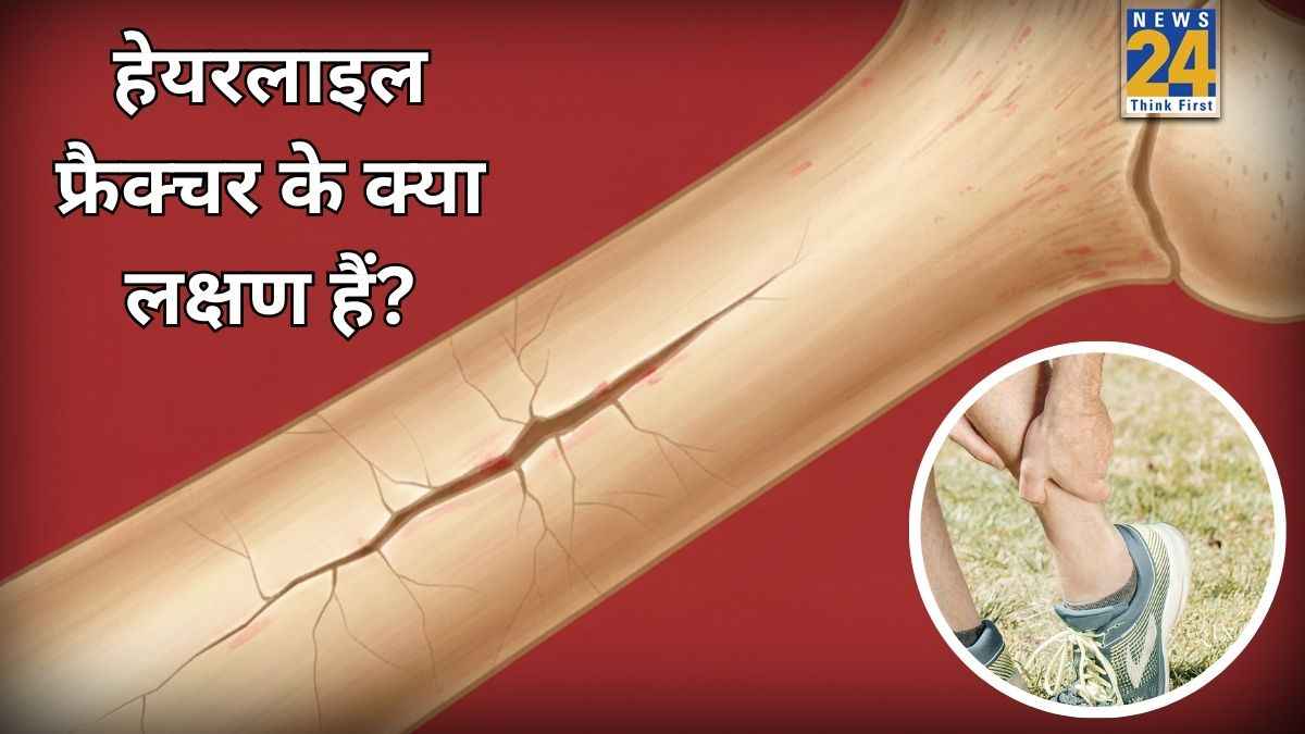 Hairline Fracture Symptoms