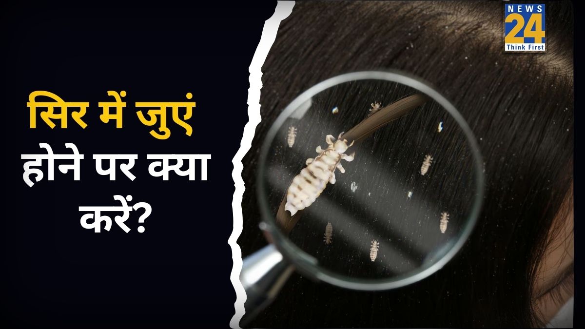 बालों में जुएं आती कहां से हैं? यहां जानिए छुटकारा पाने के लिए किन ...