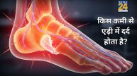 Heel pain causes