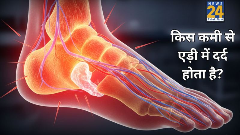 Heel pain causes