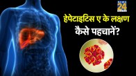 Hepatitis A