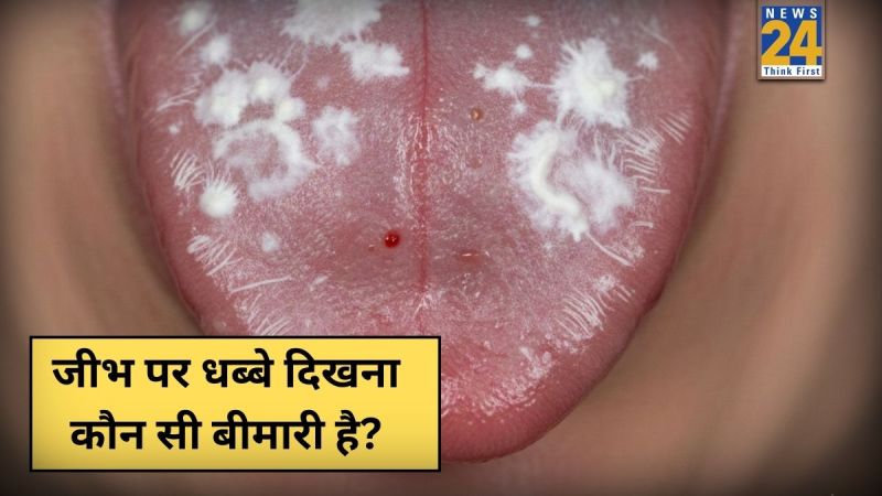 Jeebh Par Safed parat