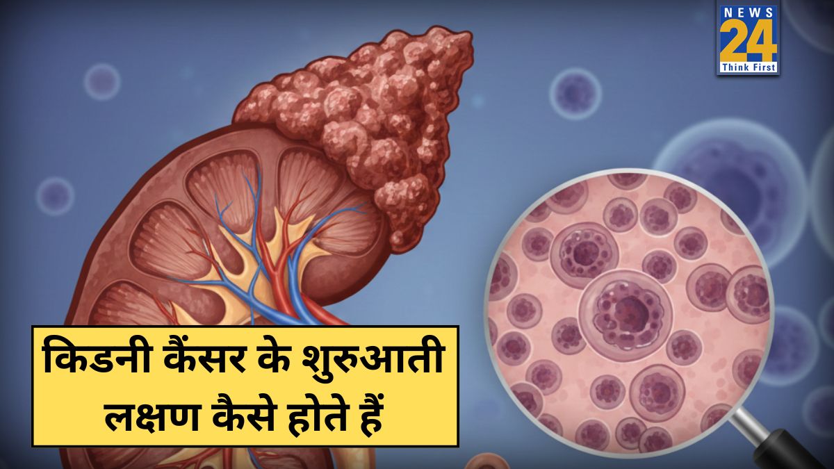 Kidney Cancer Ke Lakshan-1