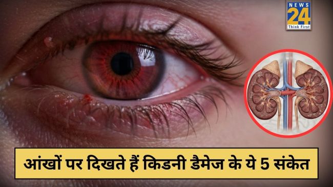 Kidney Damage Symptoms On Eyes