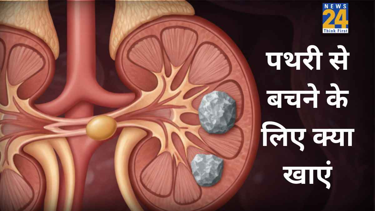 पथरी ना हो इसके लिए क्या करें? डॉक्टर ने बताया किडनी के मरीजों को क्या खाना चाहिए