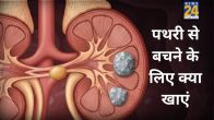 Kidney Stones