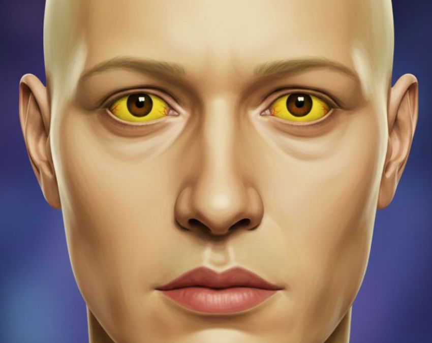 Liver Cancer Ke Kya Lakshan Hai-1-2-3-4-5-6