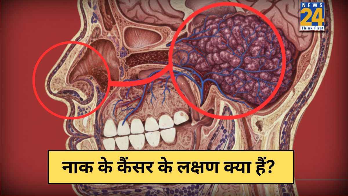 Naak Ke Cancer Ke Lakshan