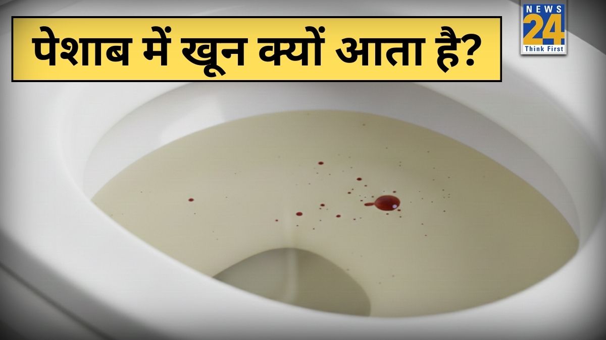 Peshab Me Khoon Peshab me khoon aaye to kya kare-1