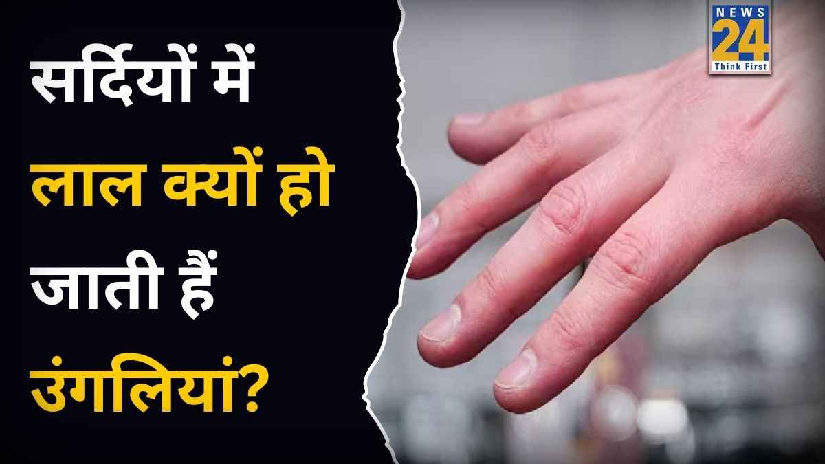 Why Fingers Turned Red In Winter