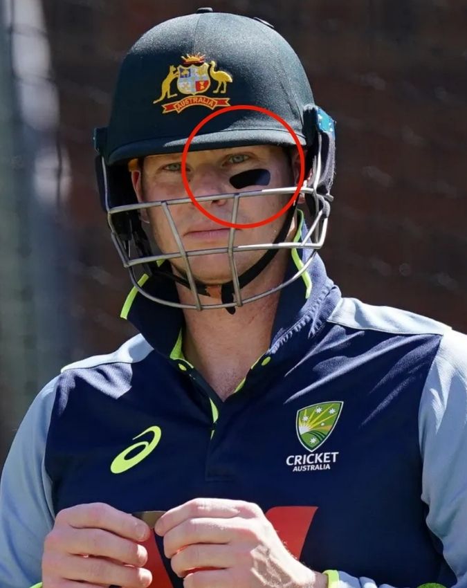 Steve Smith Black Patches -1-2-3-4-5