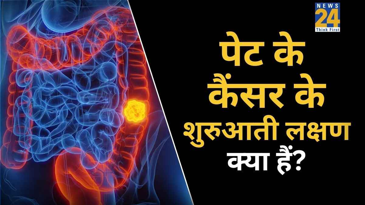 Stomach cancer