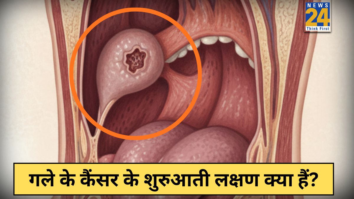 Throat Cancer Symptoms Gale Ke Cancer Ke Lakshan Throat Cancer Symptoms Gale Ke Cancer Ke Lakshan-1