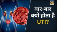 UTI Causes