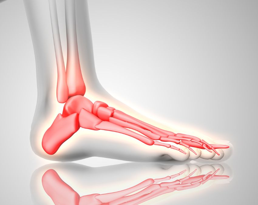 High Uric Acid-1-2-3-4-5