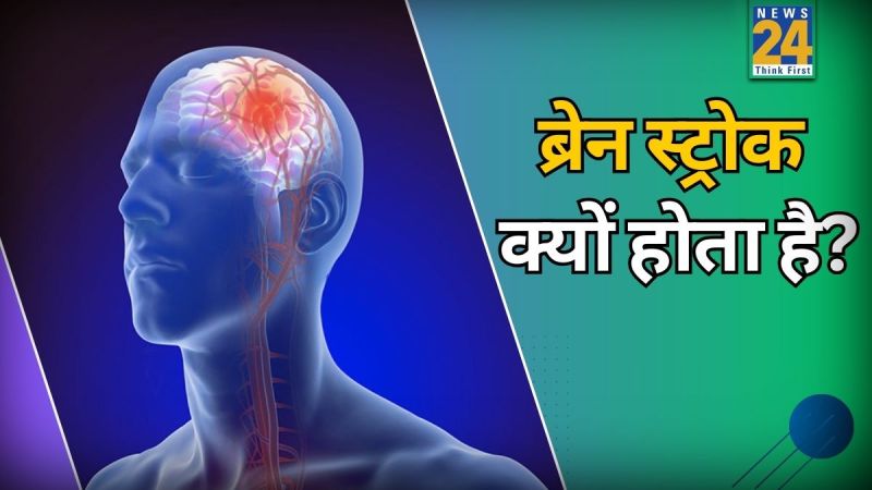 Causes Of Brain Stroke In Hindi