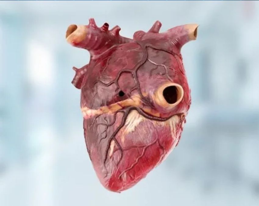 Hole in Heart Symptoms:-1-2-3-4
