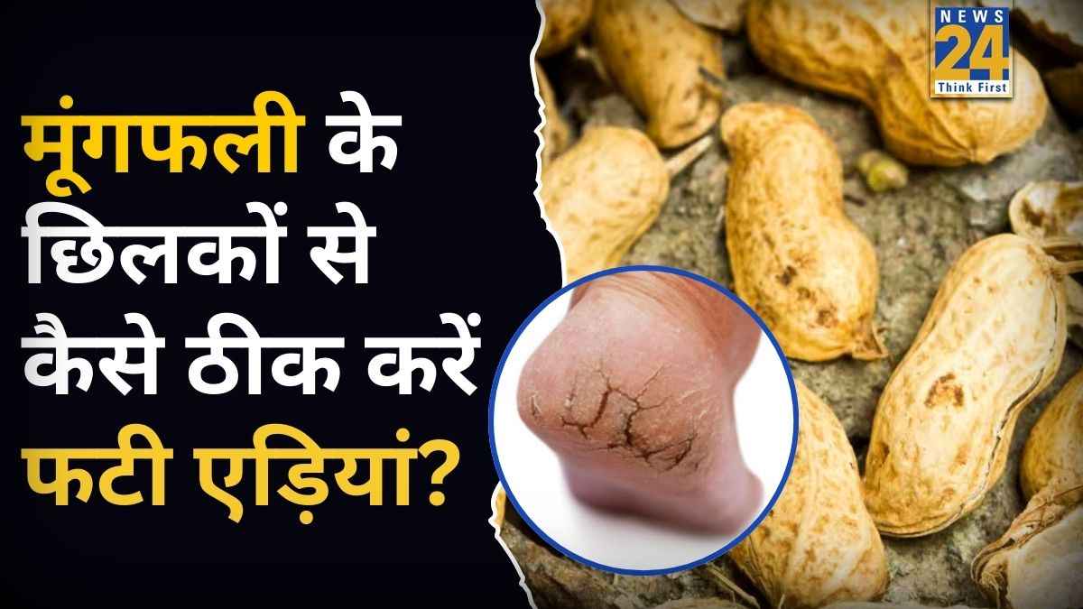 Cracked Heels Cream: मूंगफली के छिलके फेंके नहीं, यूं तैयार करें Foot Cream, फटी एड़ियां भी बन जाएंगी रुई जैसी कोमल