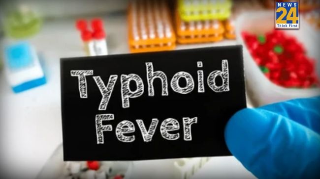 Typhoid Fever