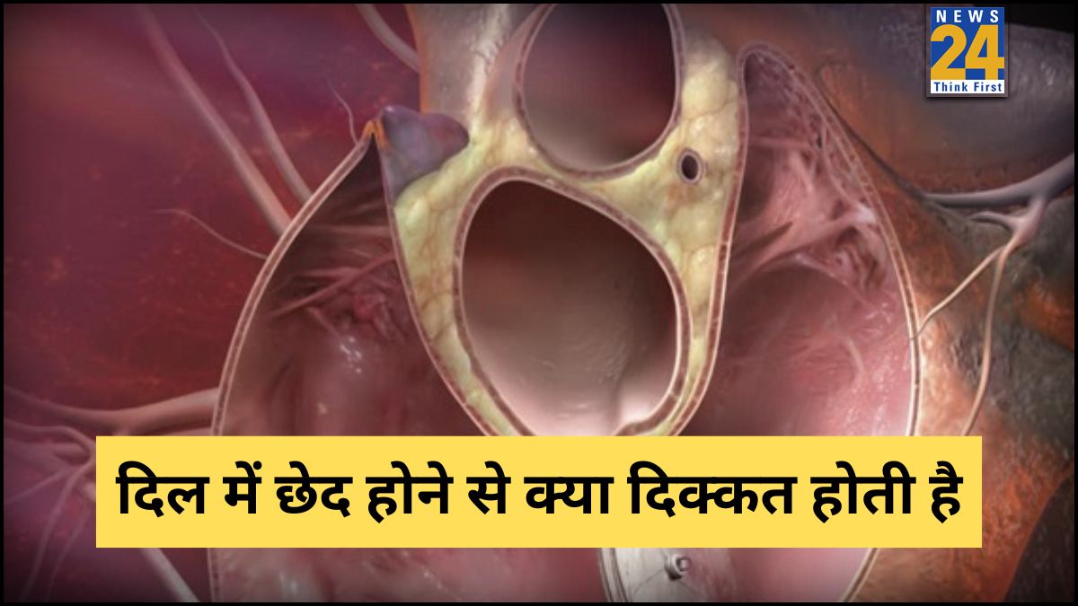 Hole in Heart Symptoms:-1