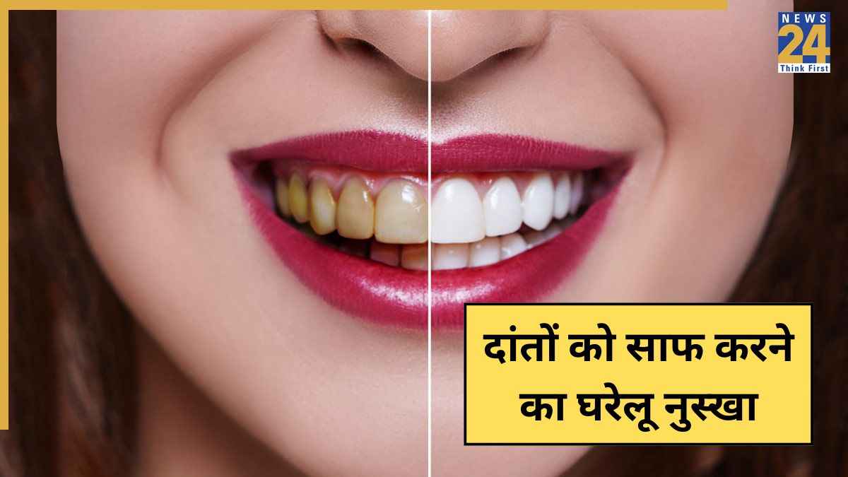 गंदे दांतों को साफ करने का रामबाण नुस्खा, किचन में रखी ये 2 सामग्रियां आएंगी आपके बहुत काम