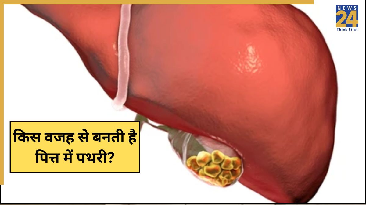 Pathri Types पित्त की पथरी में कहां दर्द होता है? जानिए पहली स्टेज में दिखने वाले 5 ...