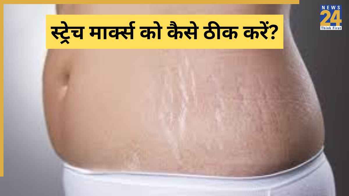 Pet Se Nishan Kaise Gayab Kare