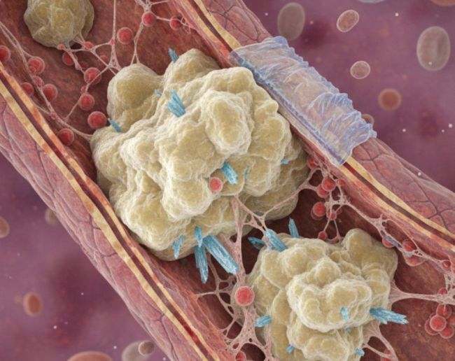 Lahsun Khane Ke Fayde-1-2-3