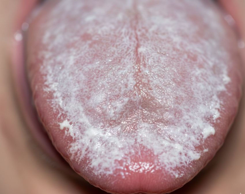 AIDS Symptoms In Men AIDS Symptoms In Men-1-2-3-4-5