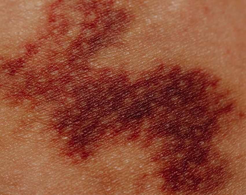 AIDS Symptoms In Men AIDS Symptoms In Men-1-2-3-4-5-6-7-8