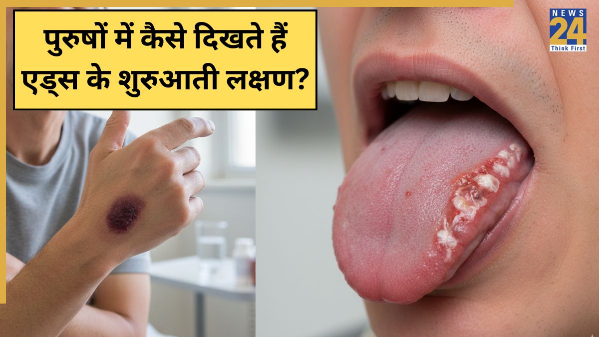 AIDS Symptoms In Men AIDS Symptoms In Men-1