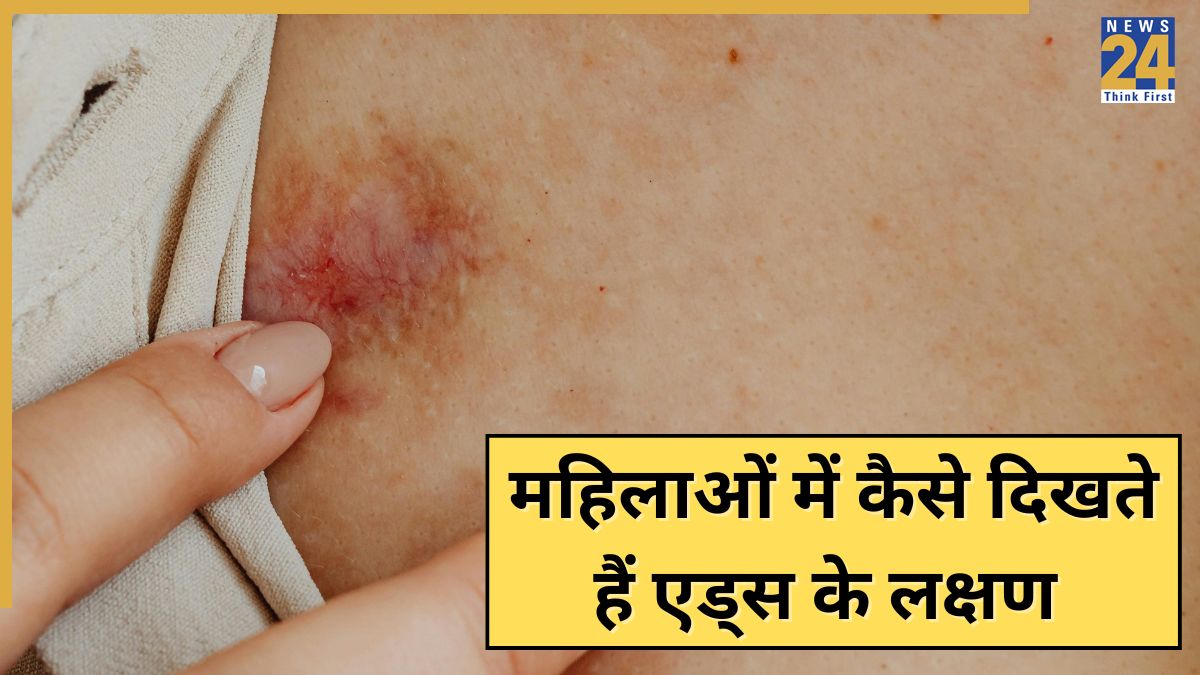 AIDS symptoms in women-1