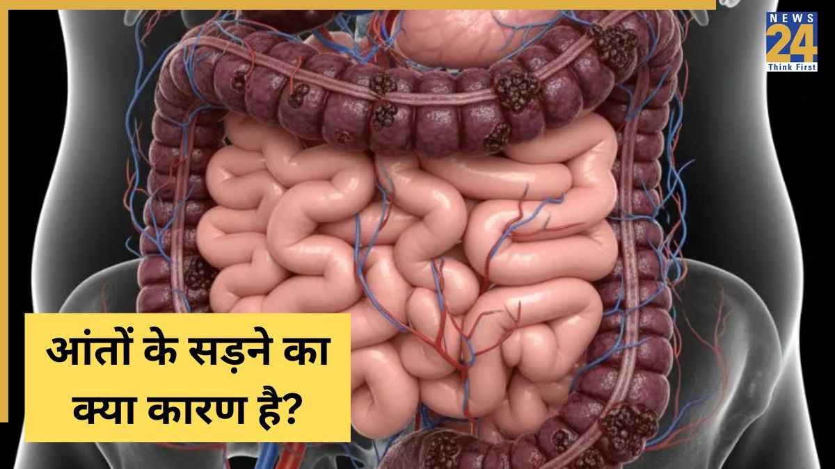 Aaant Sadne Ke Lakshan