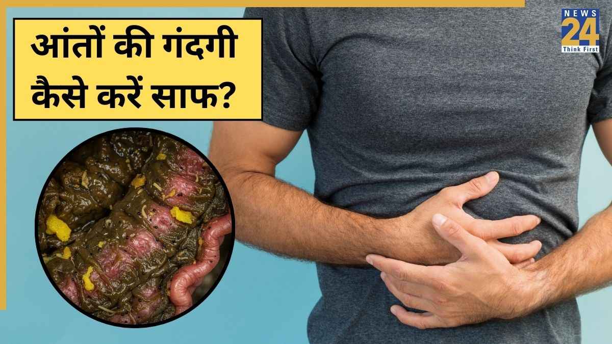 Aant Ki Gandagi Kaise Kare Saaf
