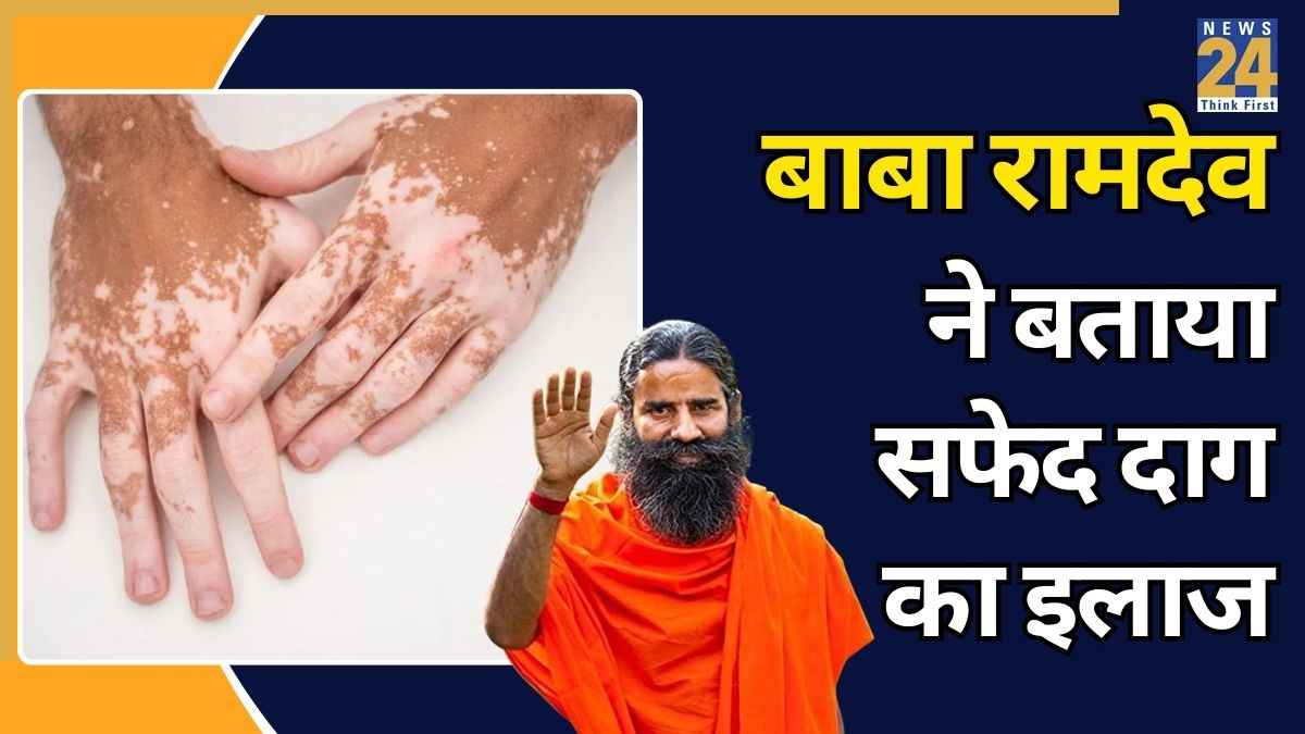 सफेद दाग को जल्दी कैसे ठीक करें? बाबा रामदेव ने बताए इलाज करने के 5 असरदार तरीके