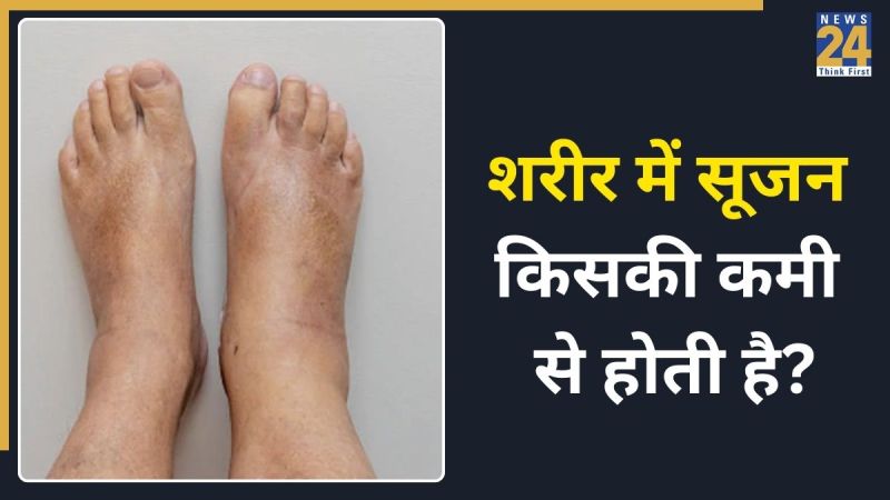Body Swelling Home Remedies