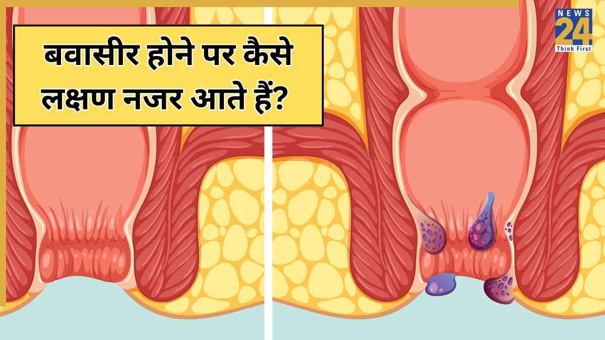 Bawasir ke lakshan