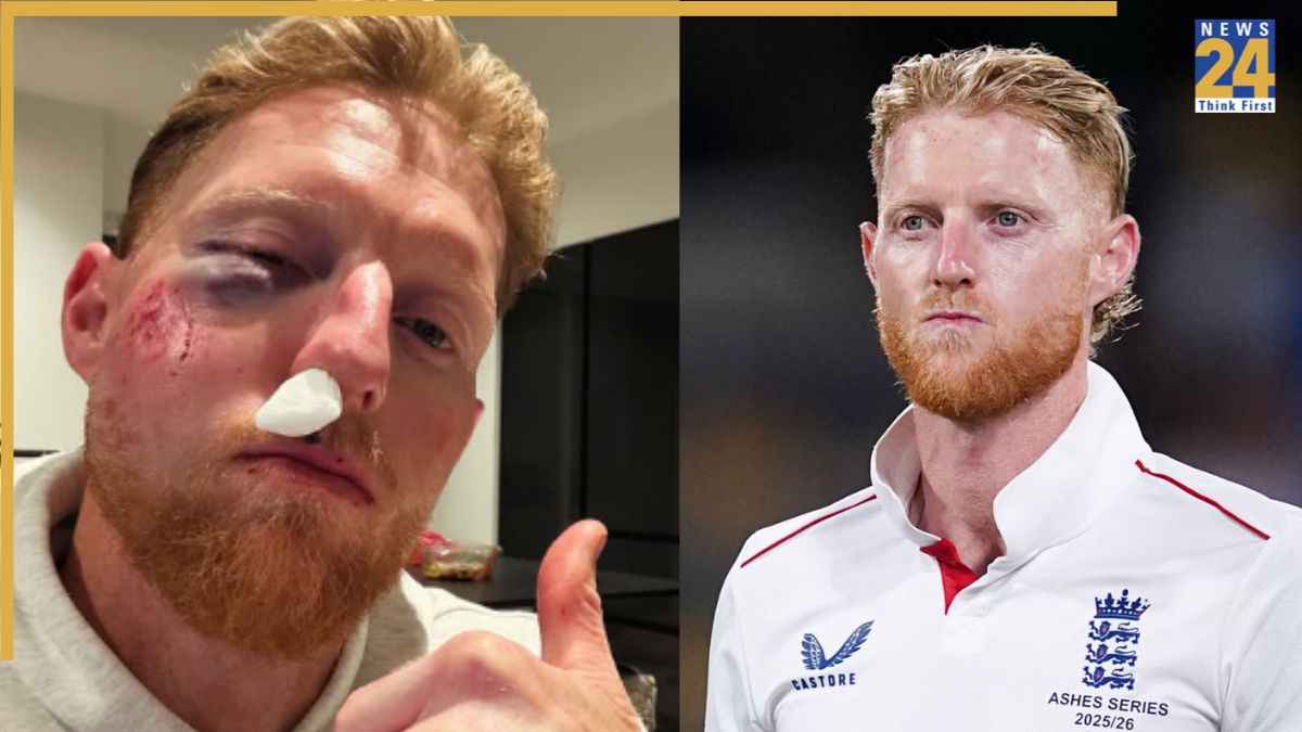 Ben Stokes Facial Injury