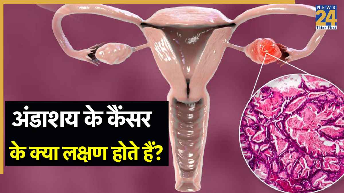 महिलाओं में Ovarian Cancer के क्या लक्षण होते हैं? अंडाशय कैंसर के इन 5 संकेतों को कभी ना करें इग्नोर