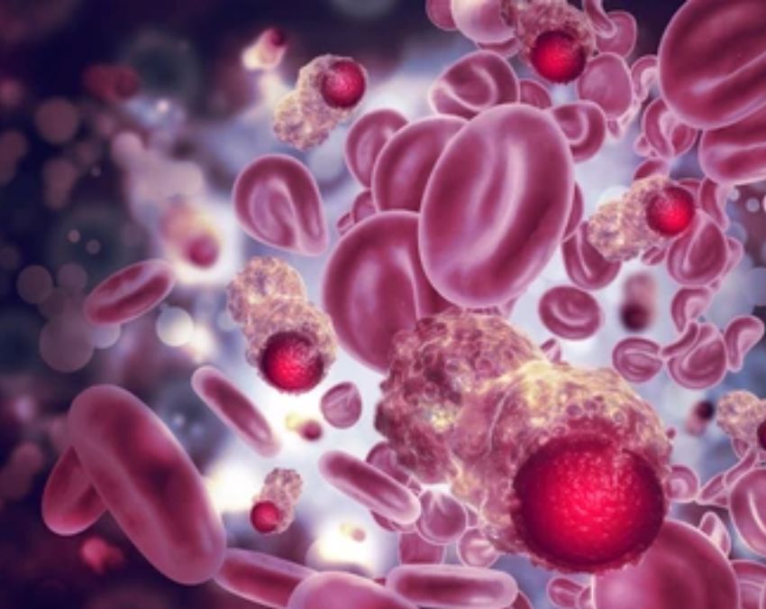 Signs Of High Blood Pressure-1-2-3-4