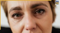 Dark Circles Home Remedy