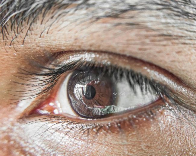 Sugar ke lakshan-1-2-3-4-5