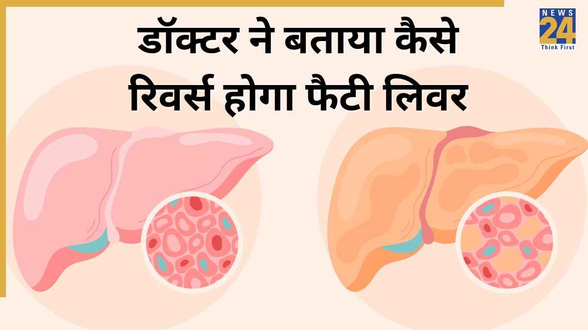 Fatty Liver Reverse