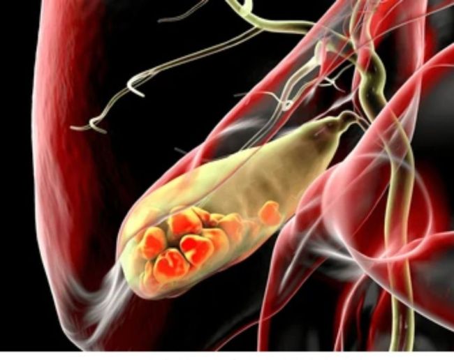 Pitte Ki Pathri Mein Dard Hona-1-2