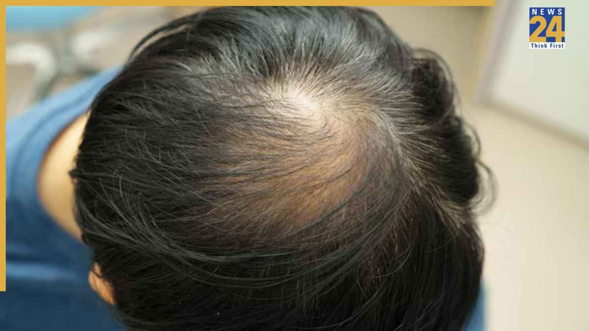 सिर पर चक्र बनना शुभ है या अशुभ? जानें भंवर को लेकर क्या कहता है सामुद्रिक शास्त्र
