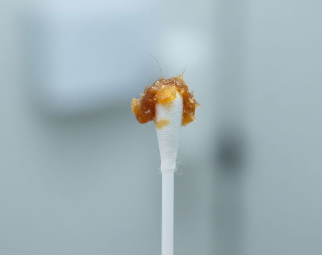 Kaan Ki Gandagi Kaise Saaf Kare Ear wax-1-2-3-4-5-6-7