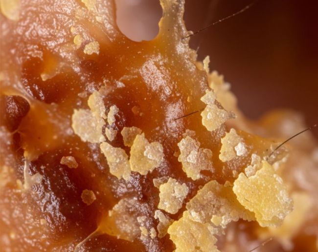 Kaan Ki Gandagi Kaise Saaf Kare Ear wax-1-2-3-4-5-6