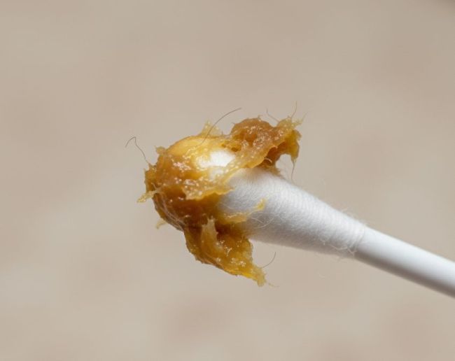 Kaan me khujli ho to kya kare ear itching home remedies-1-2-3-4-5-6-7