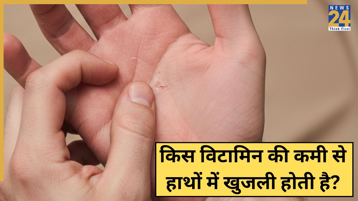 Khujli Kis Vitamin Ki Kami Se Hoti Hai Khujli Kis Vitamin Ki Kami Se Hoti Hai-1